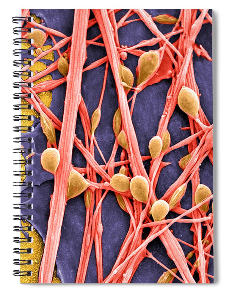 Nerve Cell Spiral Notebook featuring the photograph Neurons And Glial Cells Sem #3 by Science Source