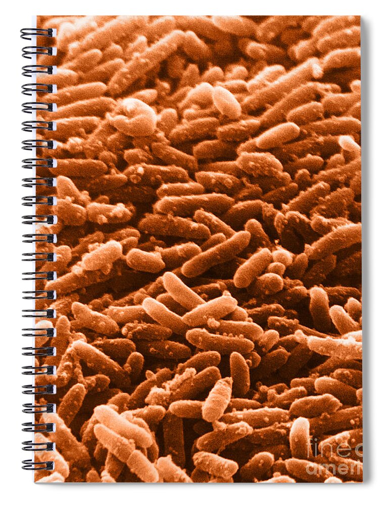 Bacterial Spiral Notebook featuring the photograph Bacteria, Sem #4 by David M. Phillips