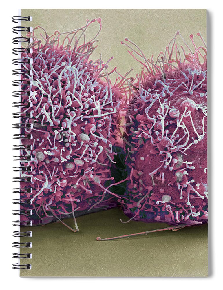 Science Spiral Notebook featuring the photograph Dividing Hela Cells, Sem by Science Source