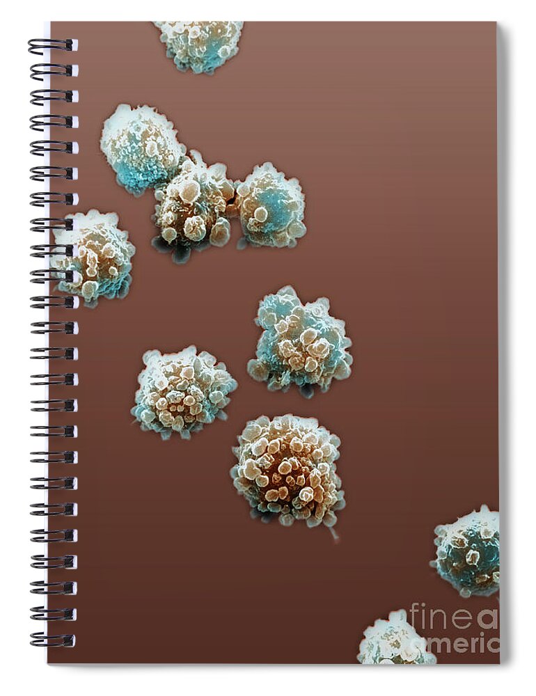 Lymphocyte Spiral Notebook featuring the photograph Lymphocytes Undergoing Apoptosis, Sem #4 by David M. Phillips