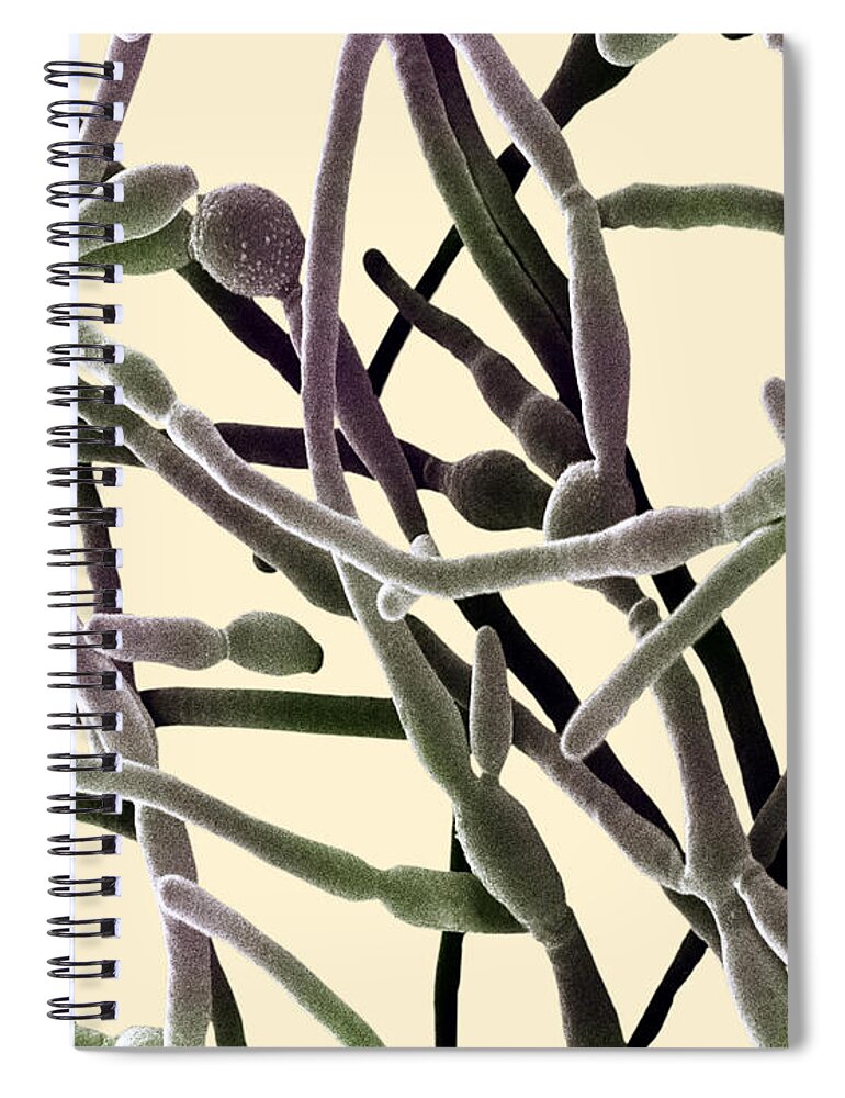 Sem Spiral Notebook featuring the photograph Scanning Electron Micrograph Of Candida #4 by David M. Phillips