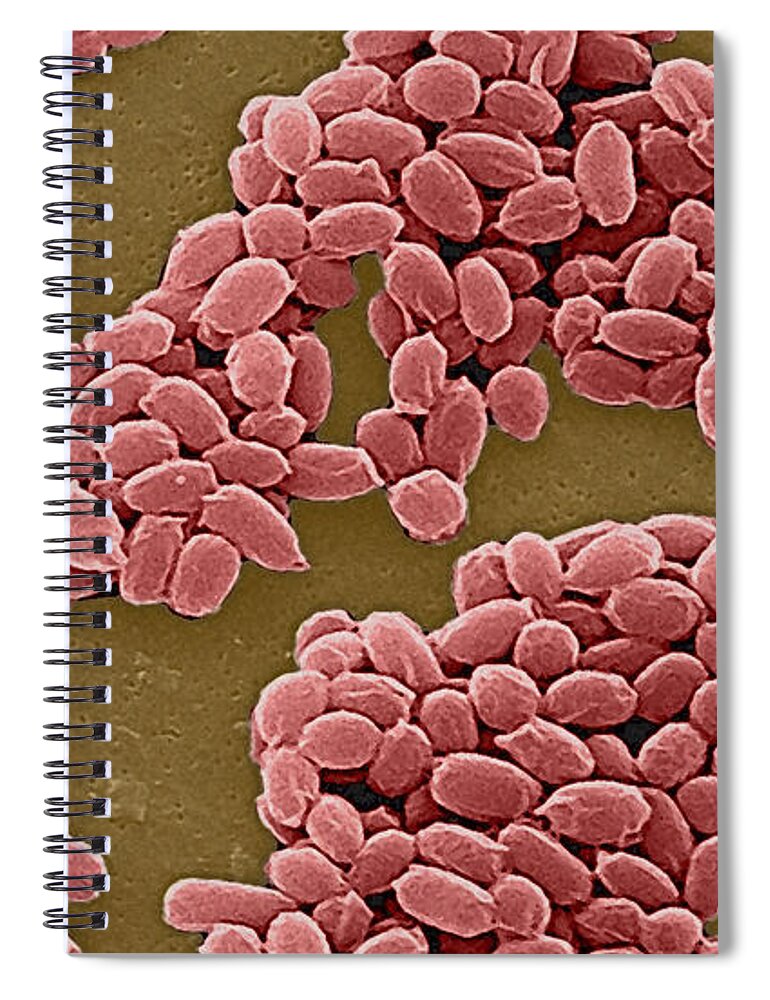 Science Spiral Notebook featuring the photograph Anthrax Bacteria Sem #5 by Science Source