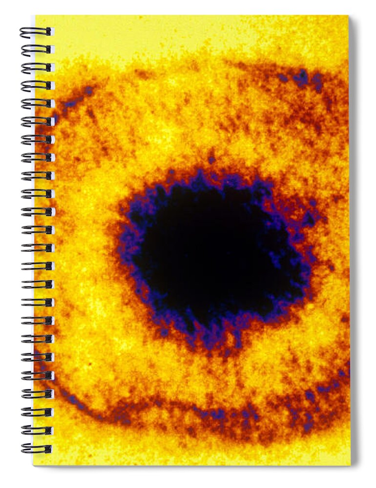 Histology Spiral Notebook featuring the photograph Herpes Simplex Virus Tem #5 by Scott Camazine