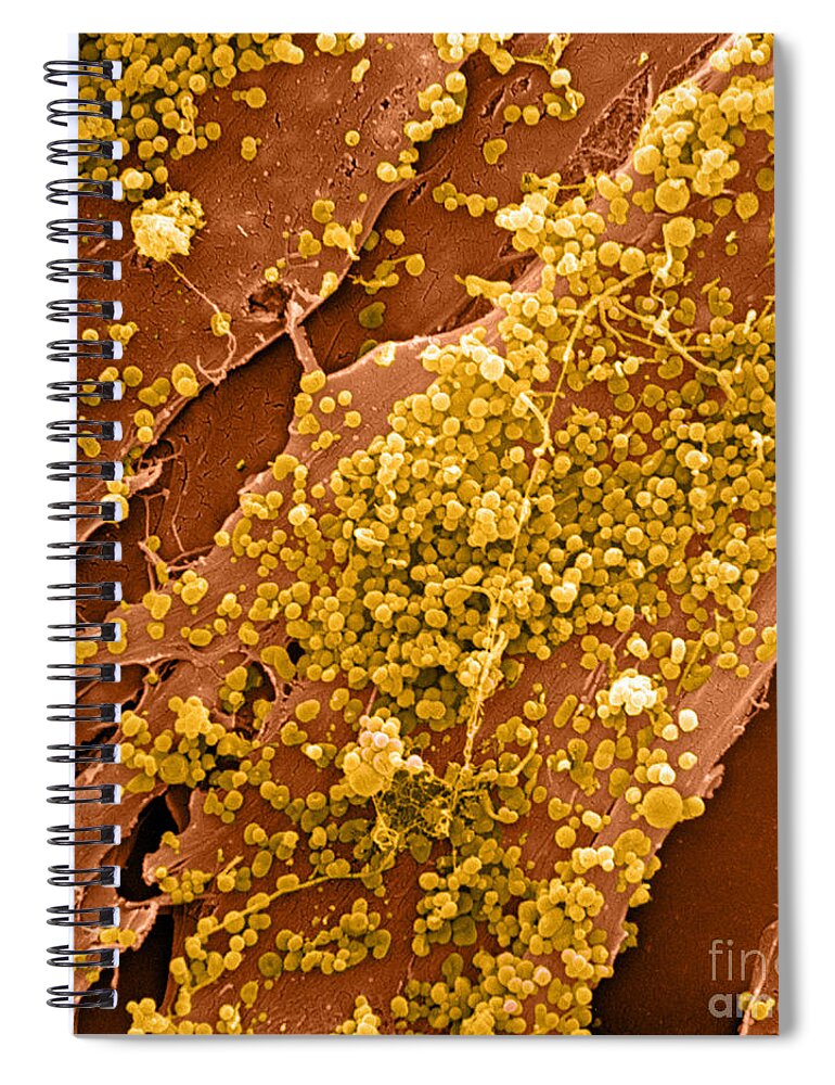 Cell Spiral Notebook featuring the photograph Human Skin Cell Sem by David M. Phillips