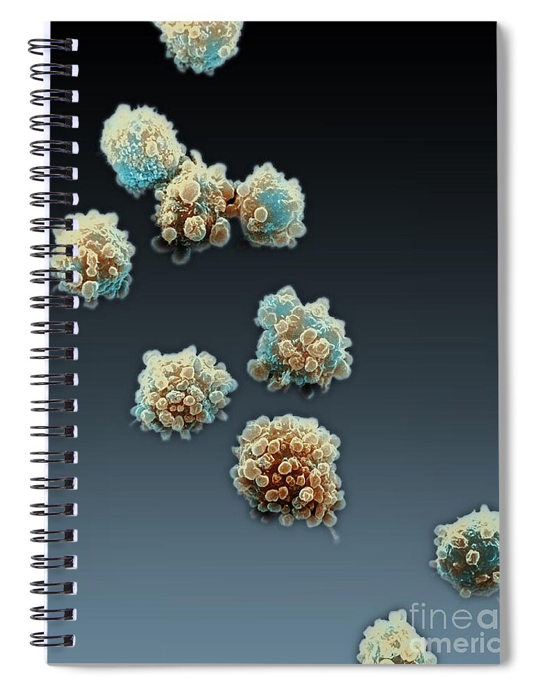 Lymphocyte Spiral Notebook featuring the photograph Lymphocytes Undergoing Apoptosis, Sem #8 by David M. Phillips