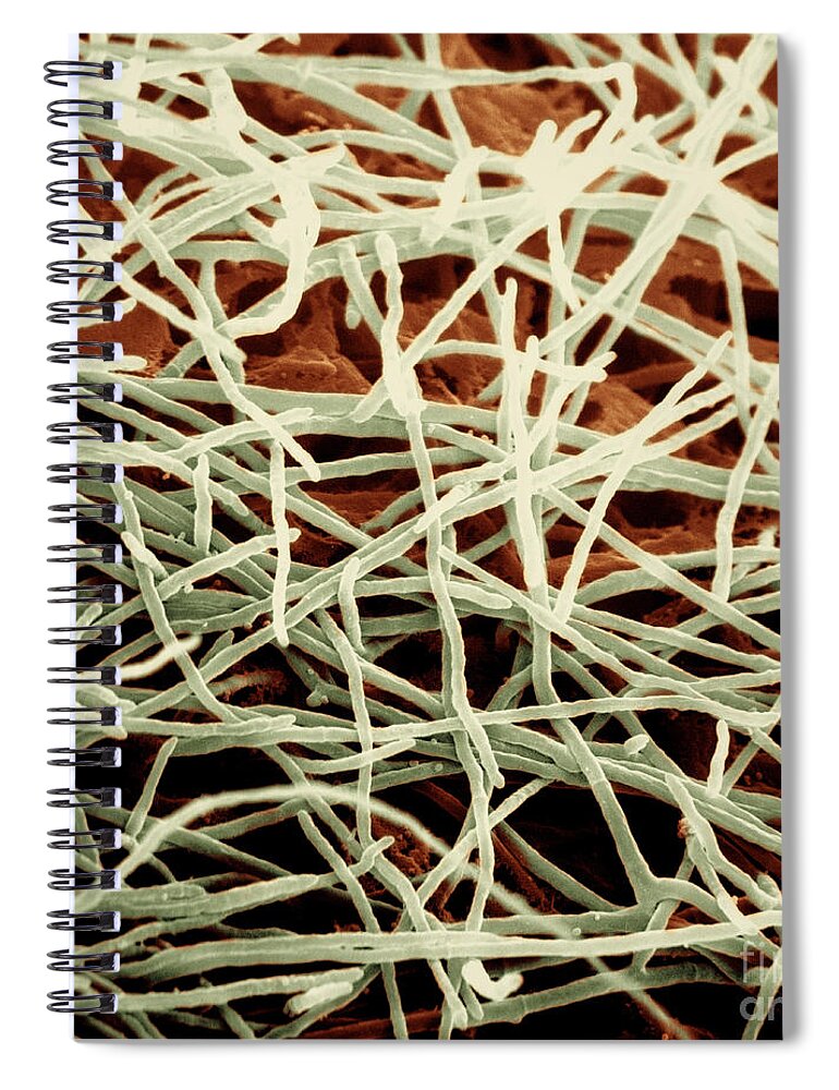 Candida Spiral Notebook featuring the photograph Candida, Sem #9 by David M. Phillips
