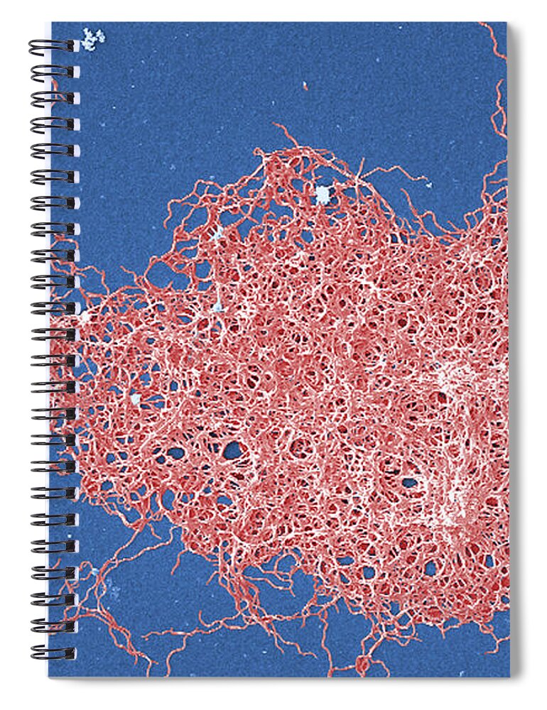Science Spiral Notebook featuring the photograph Borrelia Bacteria, Sem by Science Source