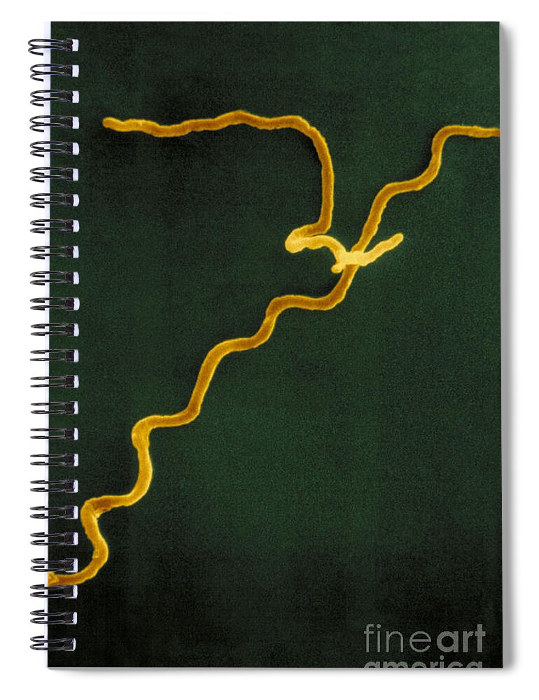 Lyme Disease Spiral Notebook featuring the photograph Borrelia Burgdorferi by David M. Phillips
