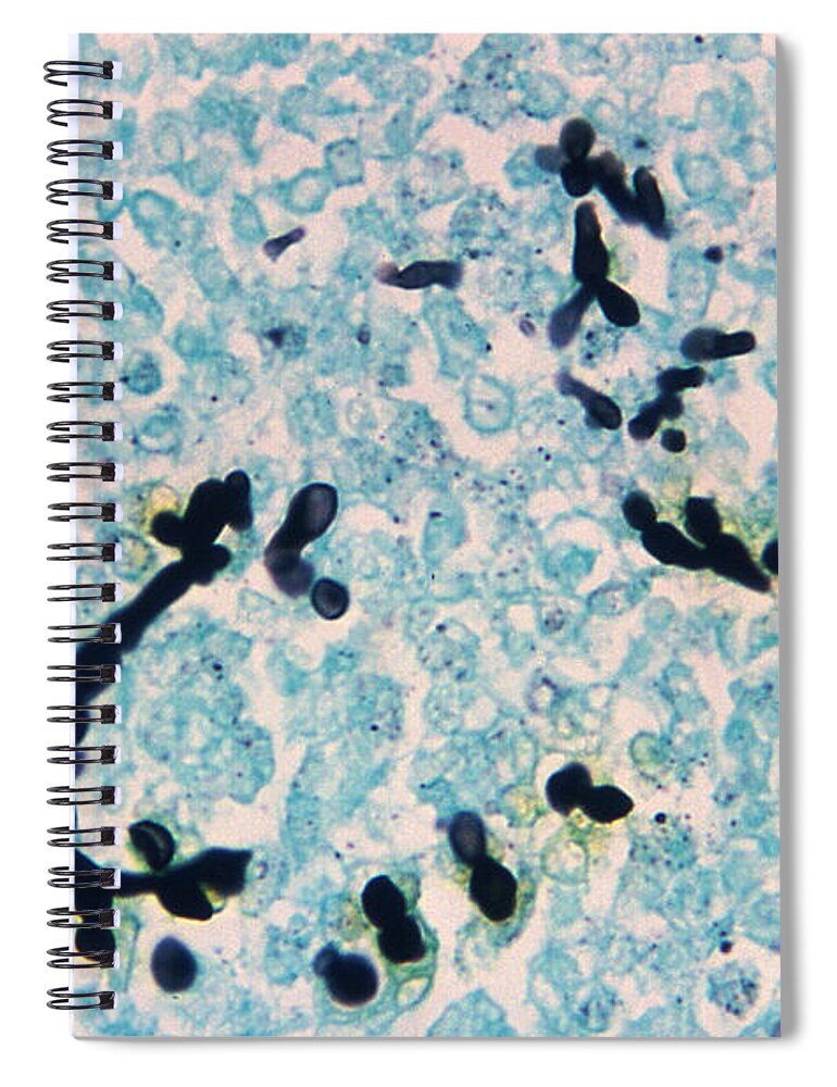 Science Spiral Notebook featuring the photograph Candida Albicans, Fungal Infection, Lm by Science Source