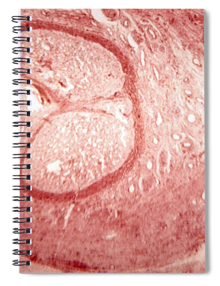 Corpus Spongiosum Spiral Notebook featuring the photograph Cross Section Of Fetal Penis, Lm by Biology Media