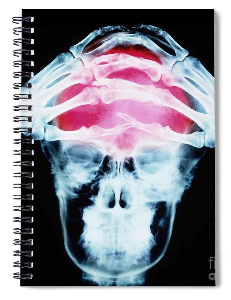 Horizontal Spiral Notebook featuring the photograph Headache by Erich Schrempp