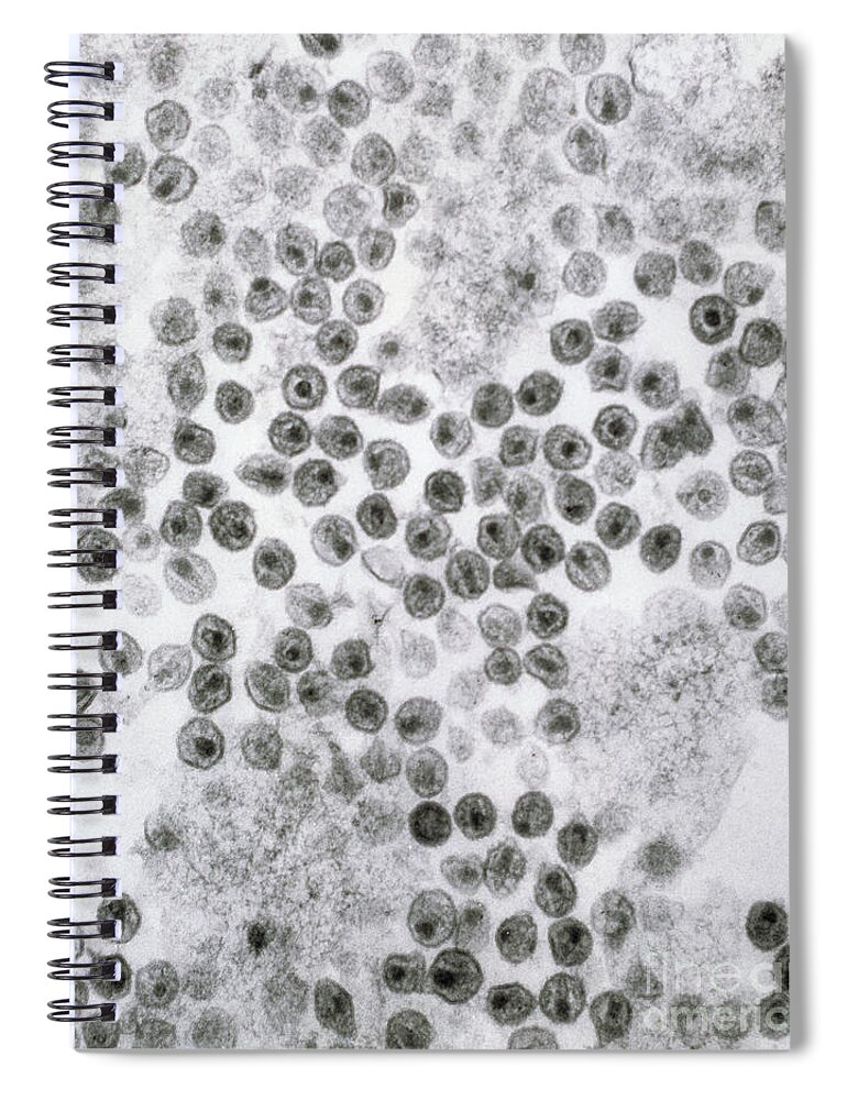 Hiv Spiral Notebook featuring the photograph Hiv Virus by David M. Phillips