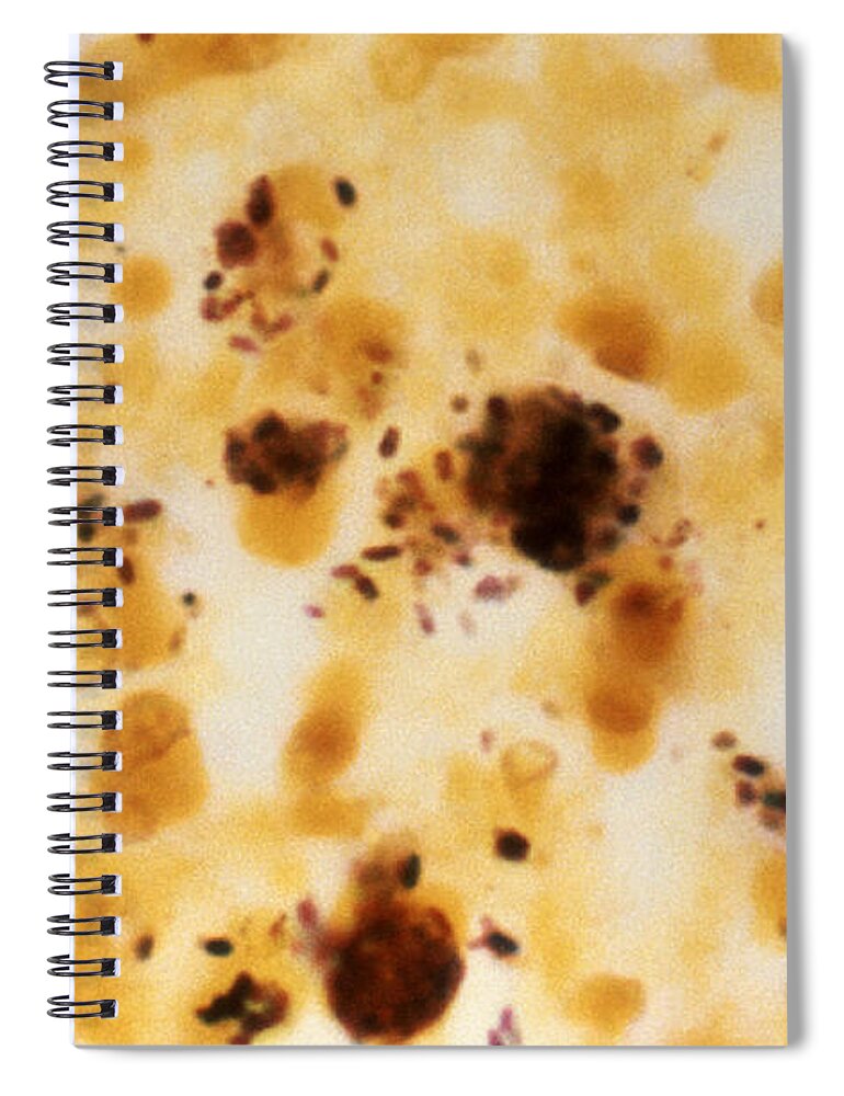 Science Spiral Notebook featuring the photograph Legionella Pneumophila Bacteria, Lm by Science Source