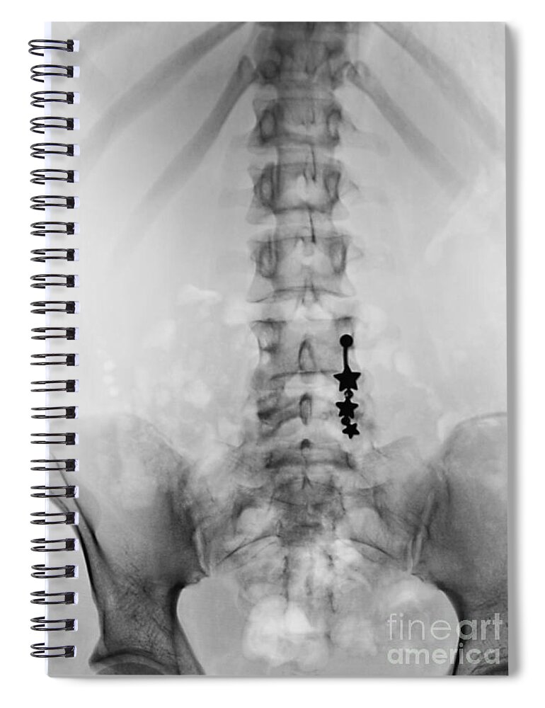 Science Spiral Notebook featuring the photograph Pierced Navel, X-ray by Scott Camazine