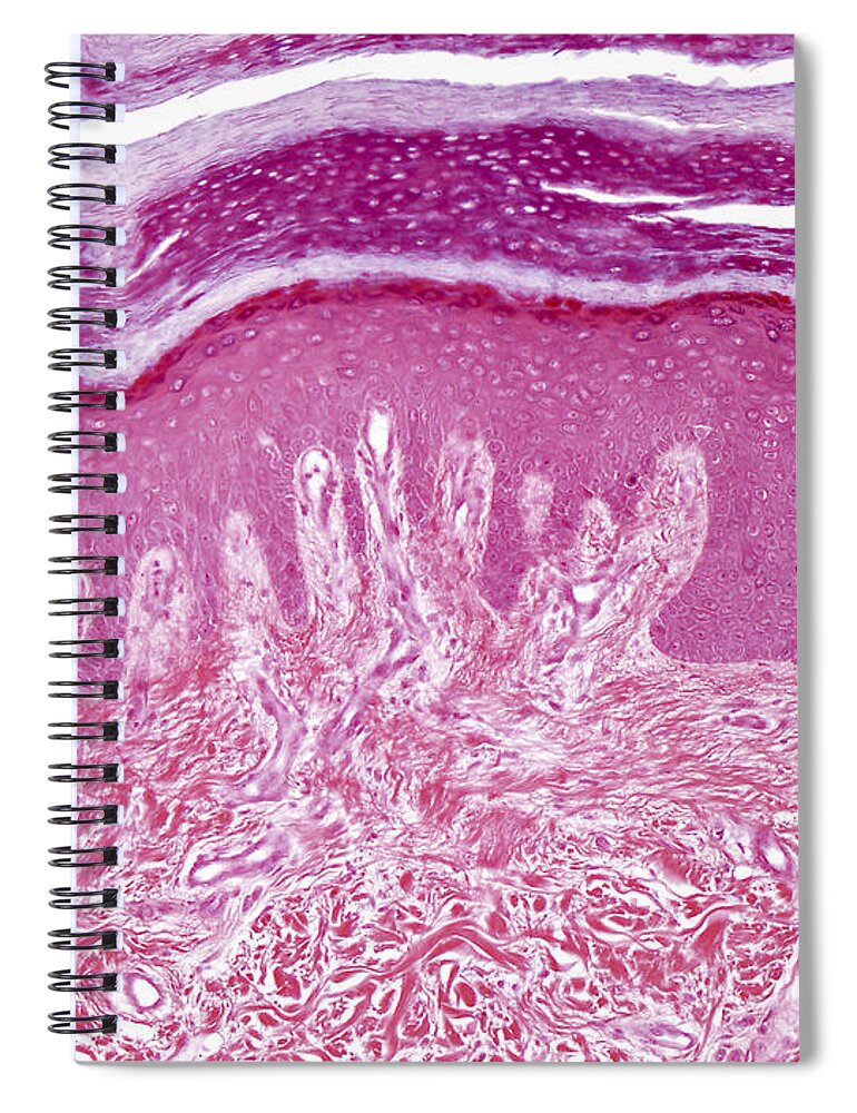 Skin Spiral Notebook featuring the photograph Plantar Skin, Lm by Alvin Telser