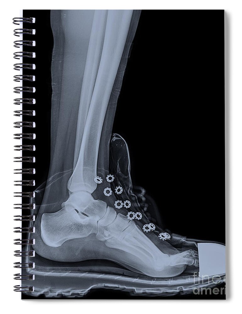 Ankle Spiral Notebook featuring the photograph running shoe X-Ray 4 by Guy Viner