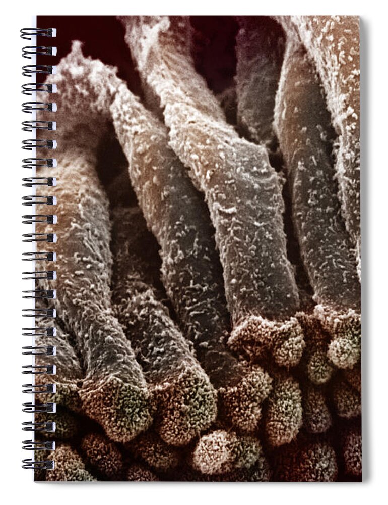 Cytology Spiral Notebook featuring the photograph Epithelium Of The Gall Bladder #1 by Science Source