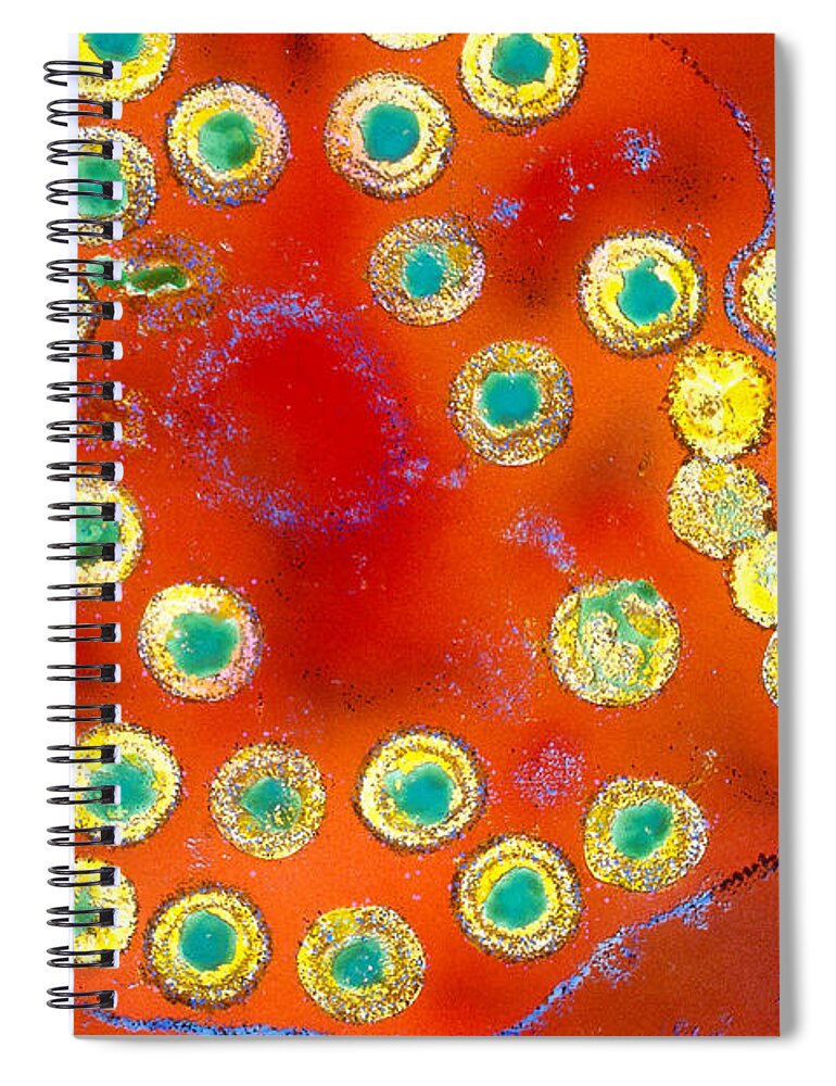 Science Spiral Notebook featuring the photograph Herpes Simplex #1 by Science Source