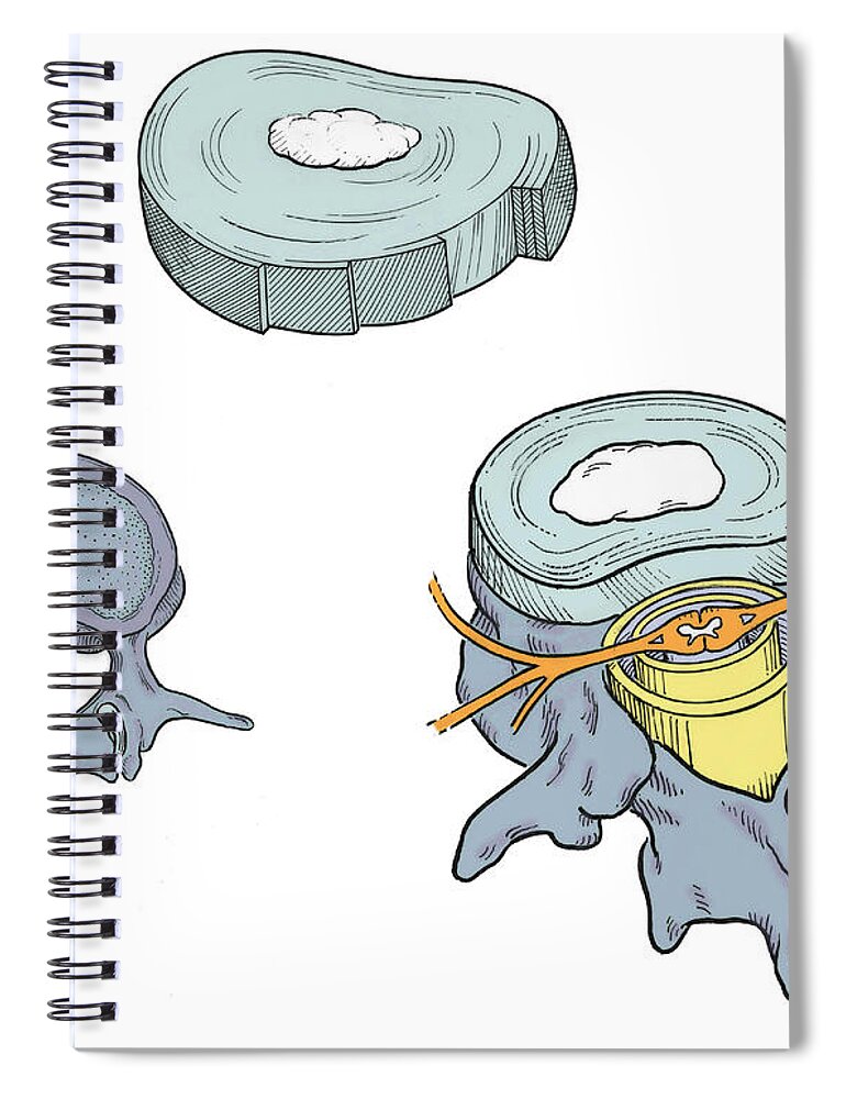 Anatomy Spiral Notebook featuring the photograph Illustration Of Spinal Disks #4 by Science Source
