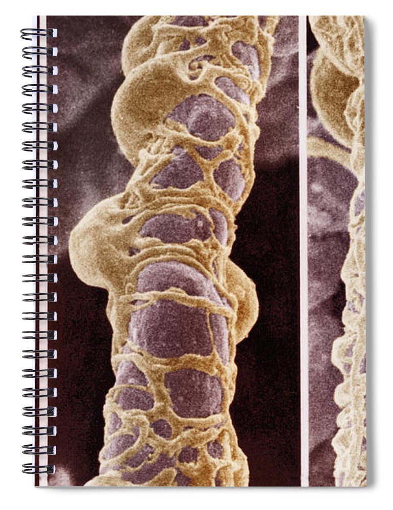 Blood Spiral Notebook featuring the photograph Pericytes #2 by Science Source