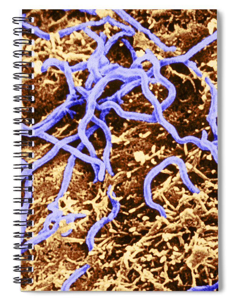 Micrograph Spiral Notebook featuring the photograph Borrelia Burgdorferi #3 by Science Source