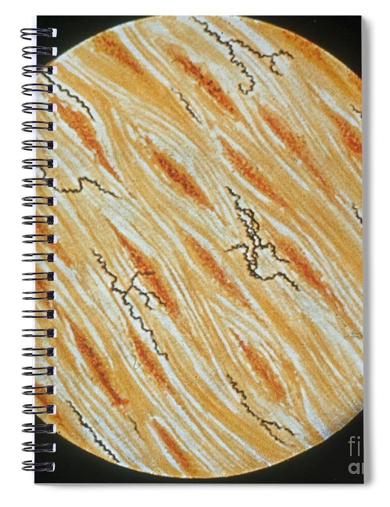 Treponema Spiral Notebook featuring the photograph Treponema Pallidum #3 by Science Source