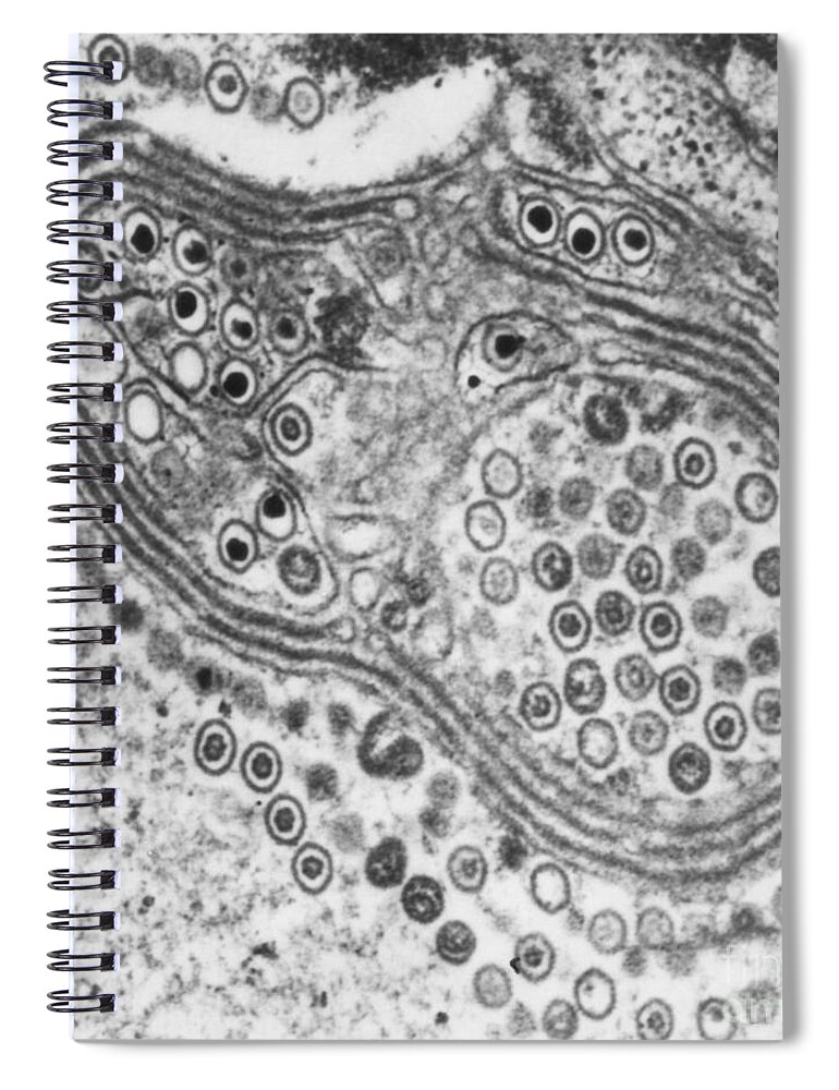 Histopathology Spiral Notebook featuring the photograph Herpes Simplex Virus, Tem #4 by Science Source