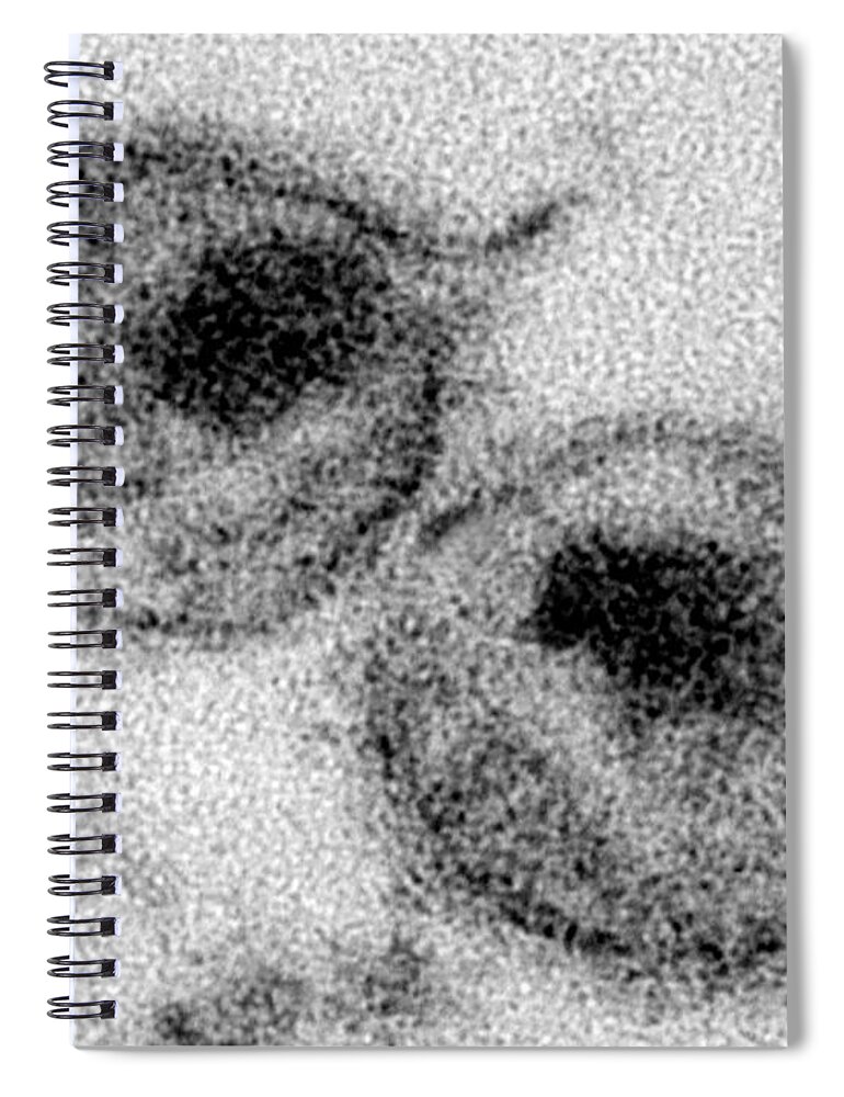 Transmission Electron Micrograph Spiral Notebook featuring the photograph Hiv #5 by Science Source