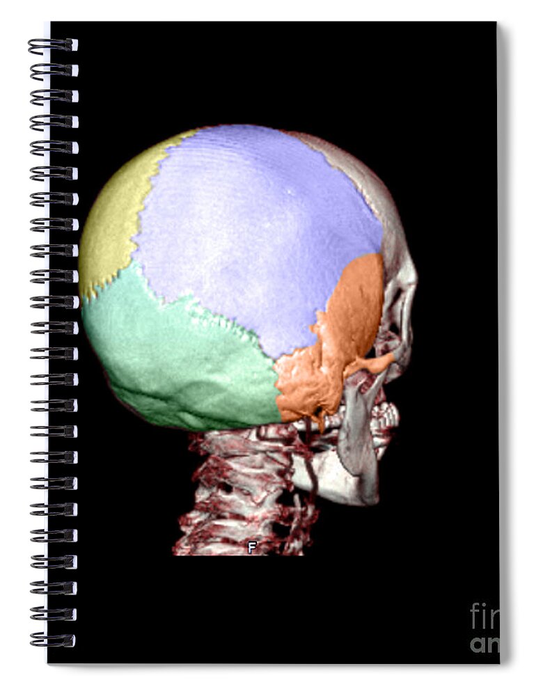 Head Spiral Notebook featuring the photograph Human Skull #8 by Medical Body Scans