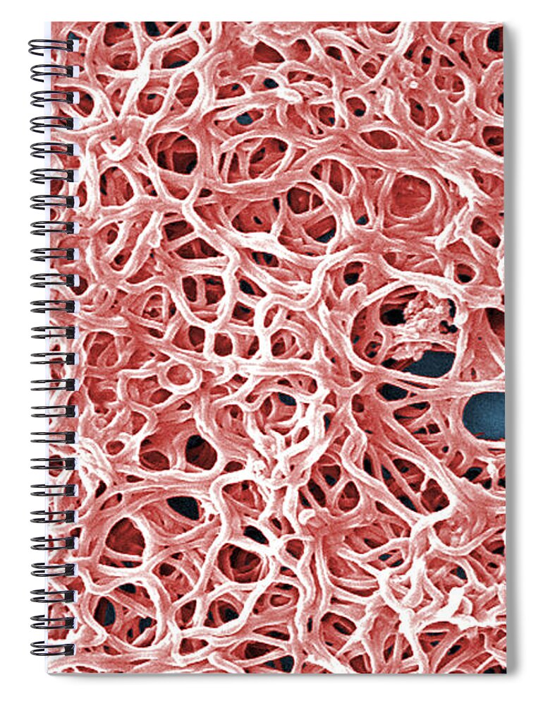 Science Spiral Notebook featuring the photograph Borrelia Burgdorferi Bacteria, Sem by Science Source