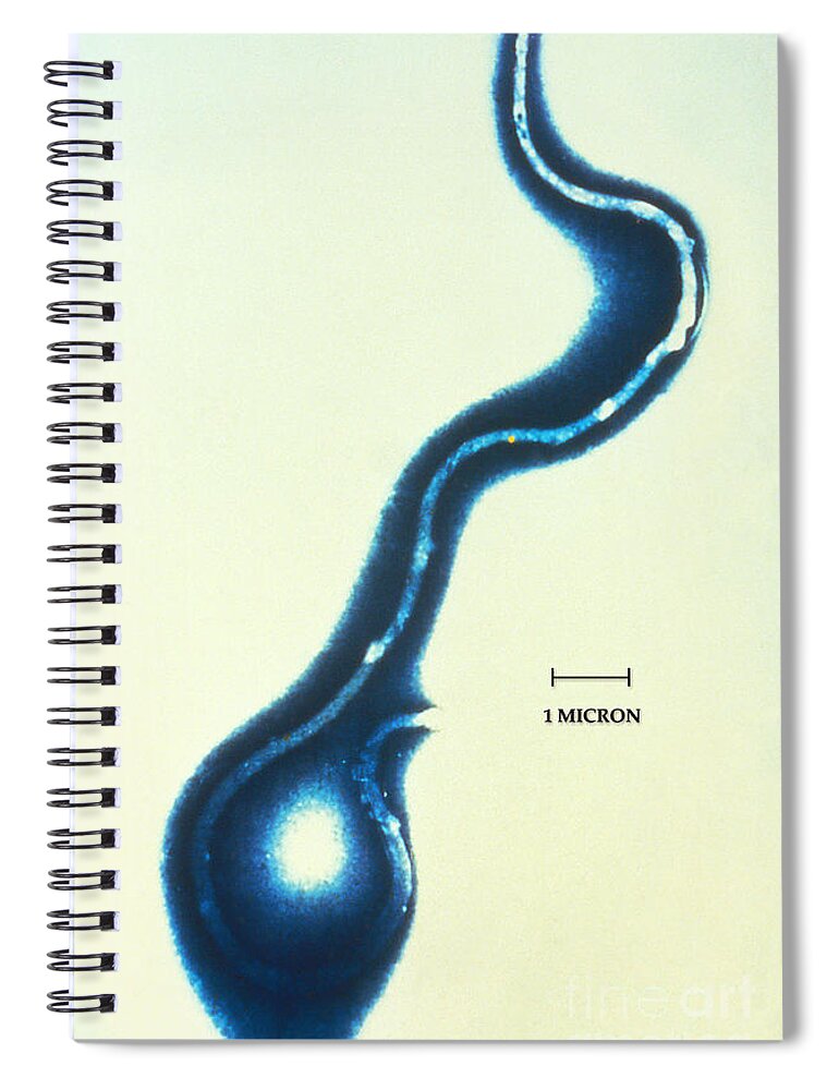 Lyme Disease Spiral Notebook featuring the photograph Borrelia Burgdorferi Lyme Disease by Science Source