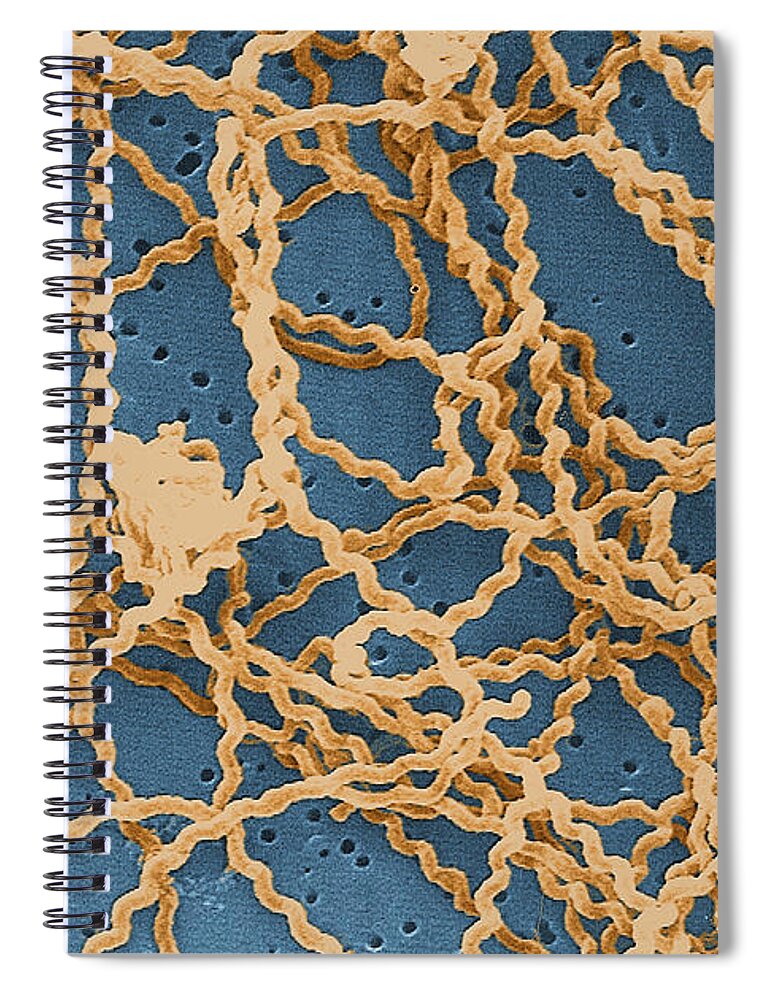 Spirochete Spiral Notebook featuring the photograph Leptospira by Science Source