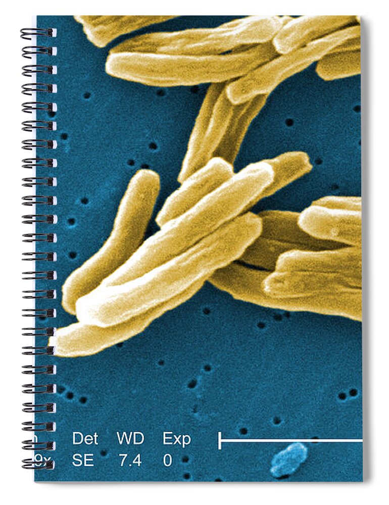 Science Spiral Notebook featuring the photograph Mycobacterium Tuberculosis, Sem by Science Source