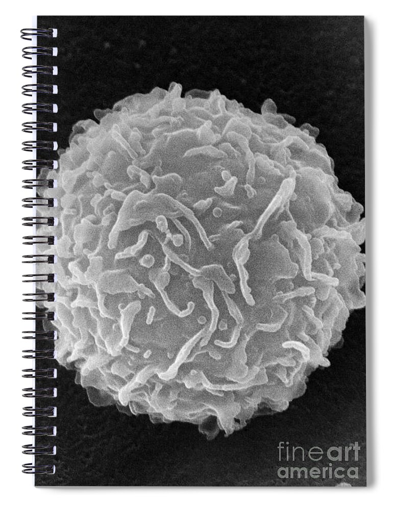 Biology Spiral Notebook featuring the photograph Mast Cell SEM by Don Fawcett and E Shelton and Photo Researchers