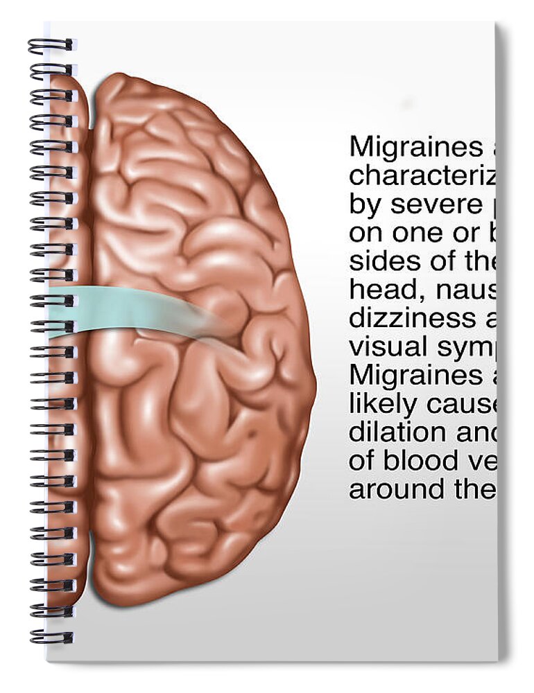 Artwork Spiral Notebook featuring the photograph Migraine, Illustration by Gwen Shockey