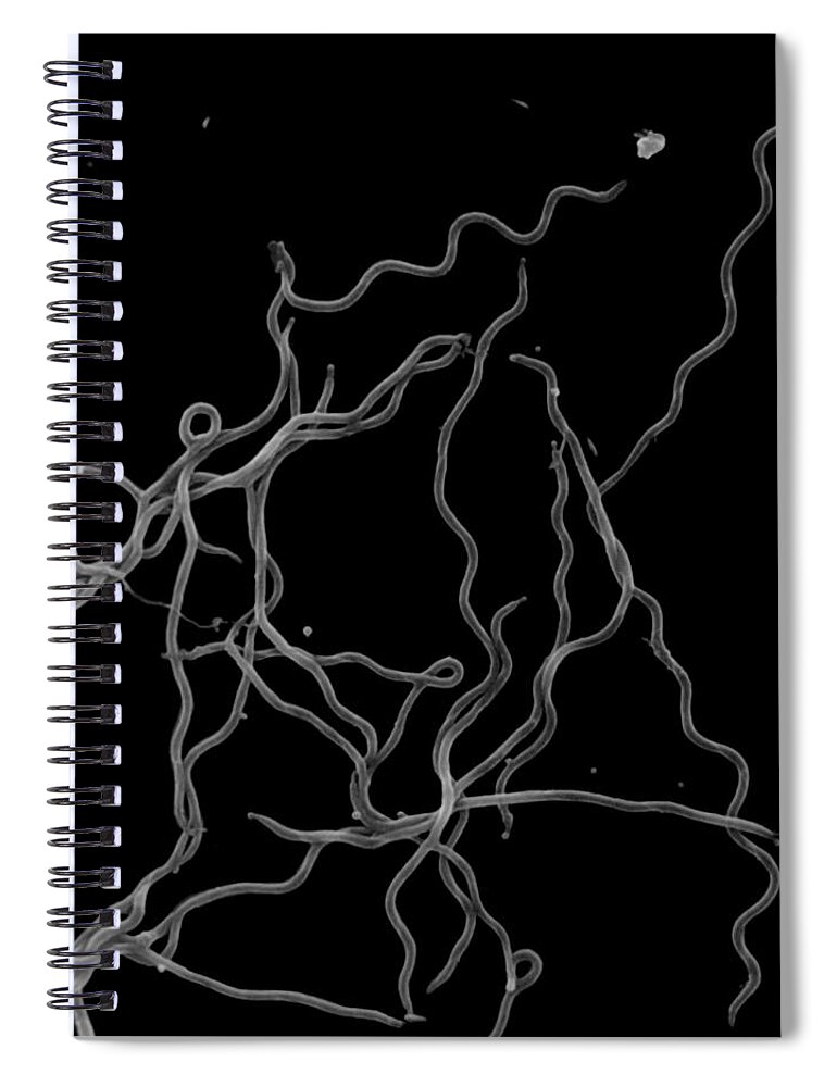 Bacteria Spiral Notebook featuring the photograph Lyme Disease, Sem #1 by Stem Jems
