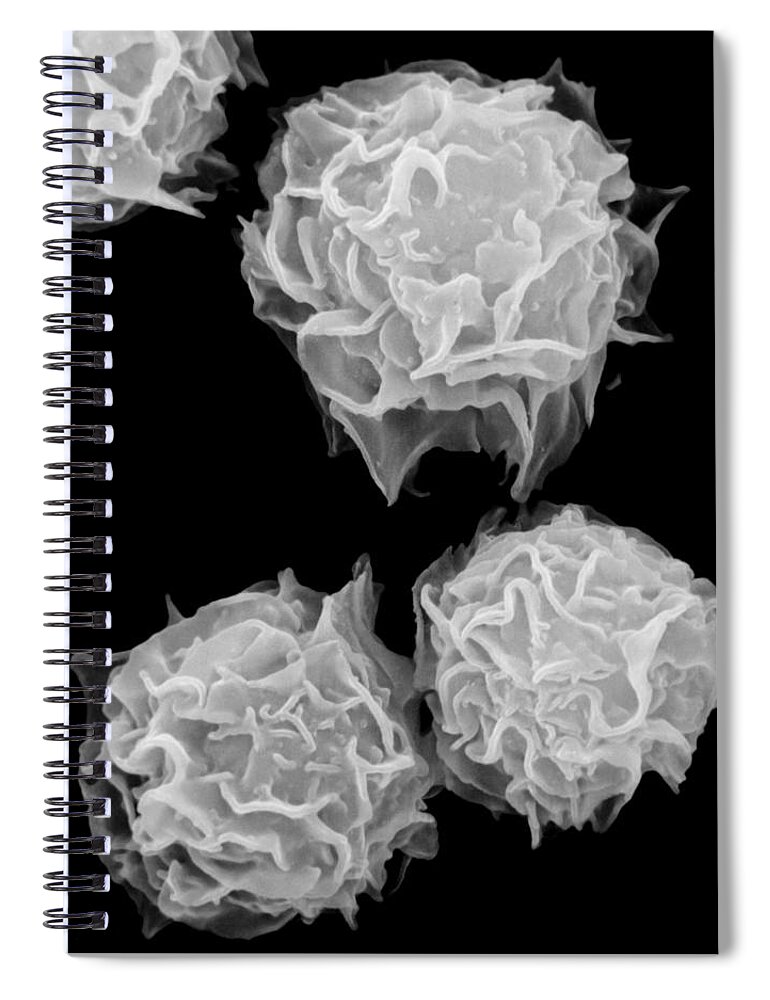 Cell Spiral Notebook featuring the photograph Mast Cells, Sem #1 by Stem Jems