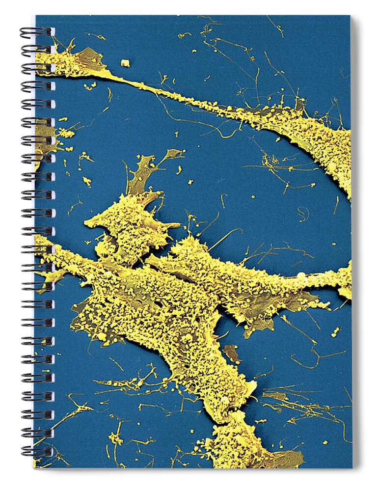 Cancer Spiral Notebook featuring the photograph Neuroblastoma Cells #1 by Meckes/ottawa