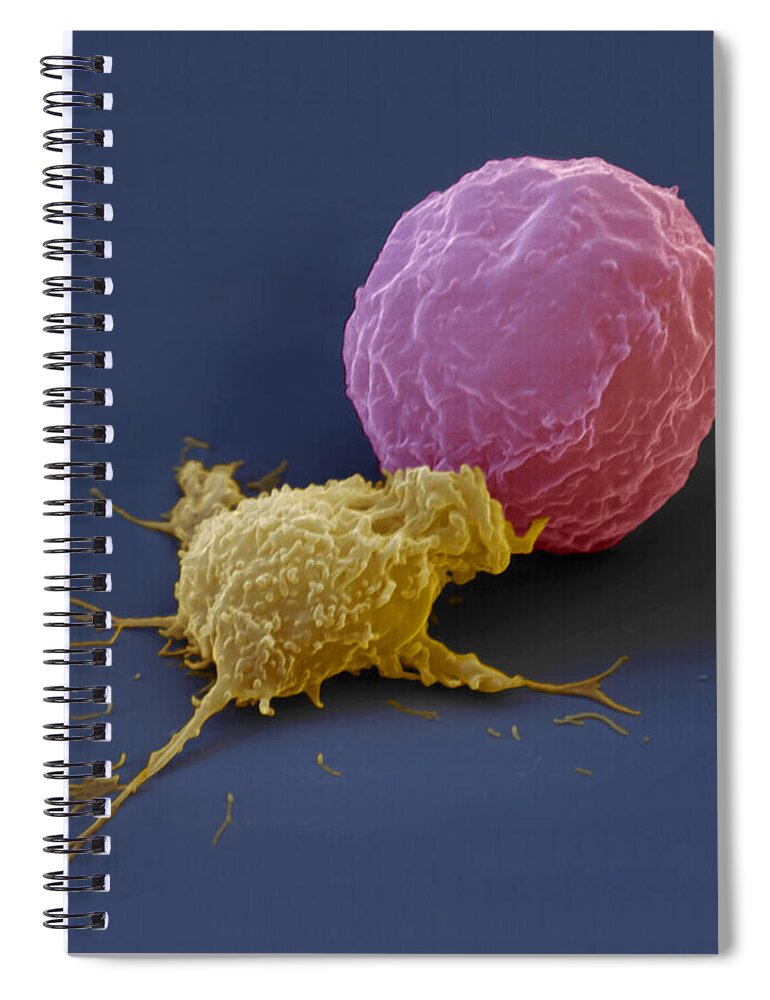 Antigen Spiral Notebook featuring the photograph Killer Cell And Cancer Cell by Meckes/ottawa