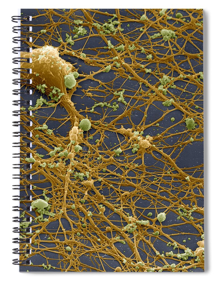 Brain Spiral Notebook featuring the photograph Nerve Cells Grown In Culture by Meckes/ottawa