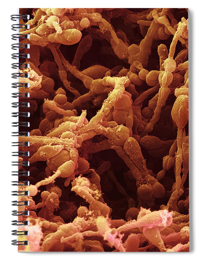 Athlete's Foot Spiral Notebook featuring the photograph Ringworm Fungus by Oliver Meckes EYE OF SCIENCE