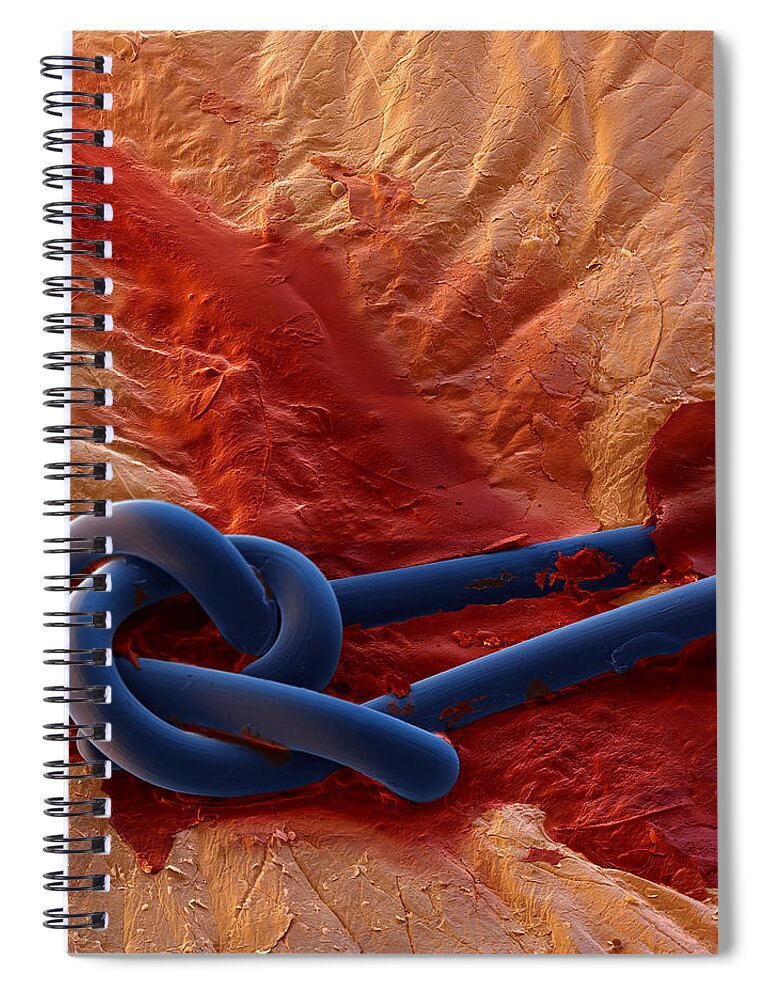 Blood Spiral Notebook featuring the photograph Scar And Stitches by Meckes Ottawa