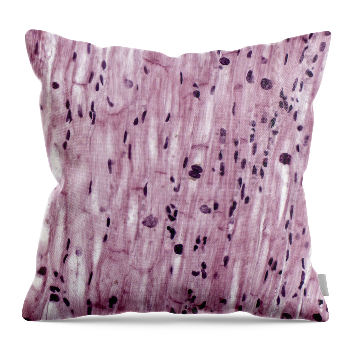 Cardiac Muscle Throw Pillow featuring the photograph Cardiac Muscle With Purkinje Fibers, Lm #2 by Alvin Telser