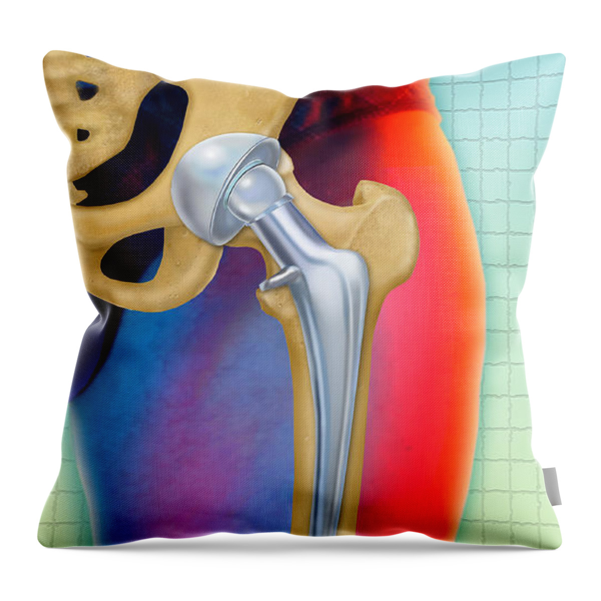 Art Throw Pillow featuring the photograph Prosthetic Hip Replacement #1 by Chris Bjornberg