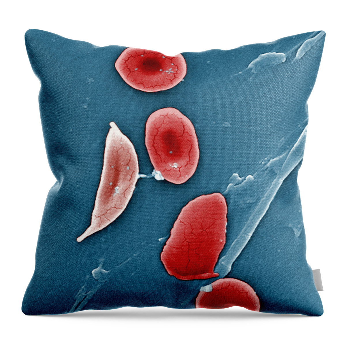 Science Throw Pillow featuring the photograph Sickle Cell Anemia, Human Rbcs, Sem #2 by Science Source