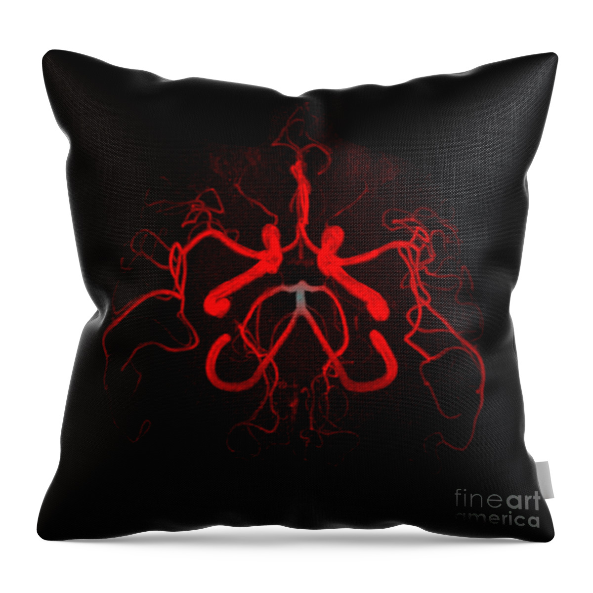 Intracranial Mra Throw Pillow featuring the photograph Normal Intracranial Mra #4 by Living Art Enterprises