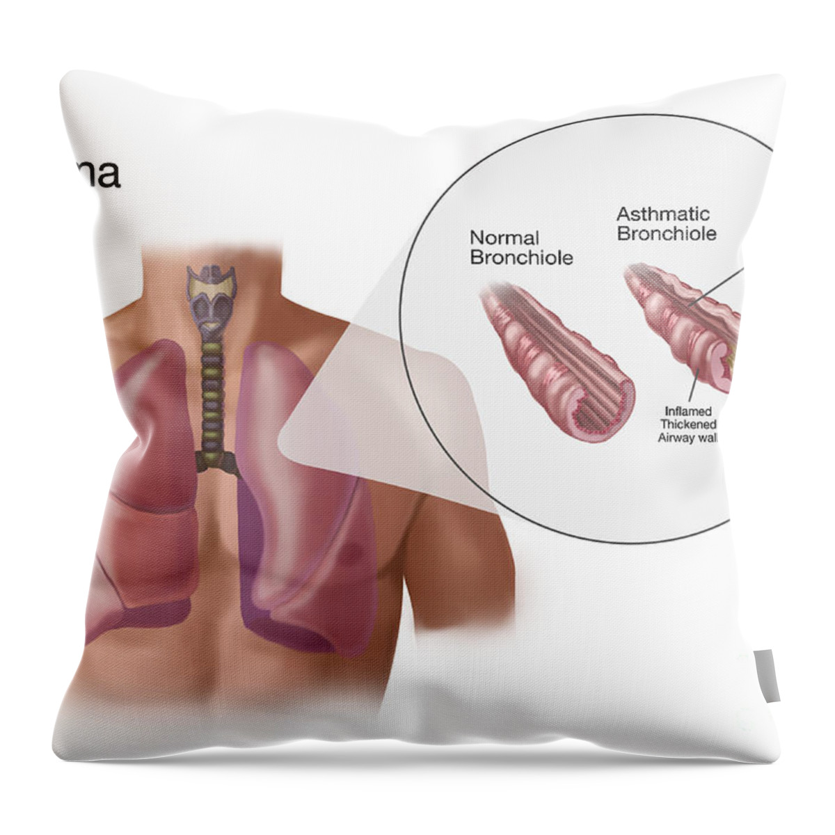 Science Throw Pillow featuring the photograph Asthma And Bronchioles by Spencer Sutton