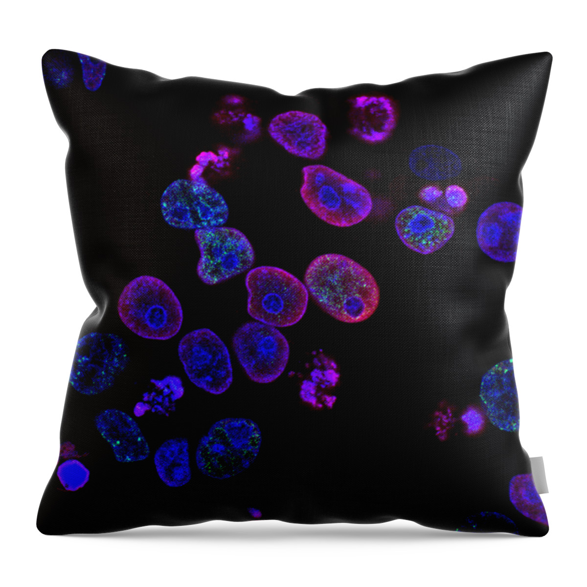 Science Throw Pillow featuring the photograph Colorectal Cancer Cells Damaged By Atr by Science Source