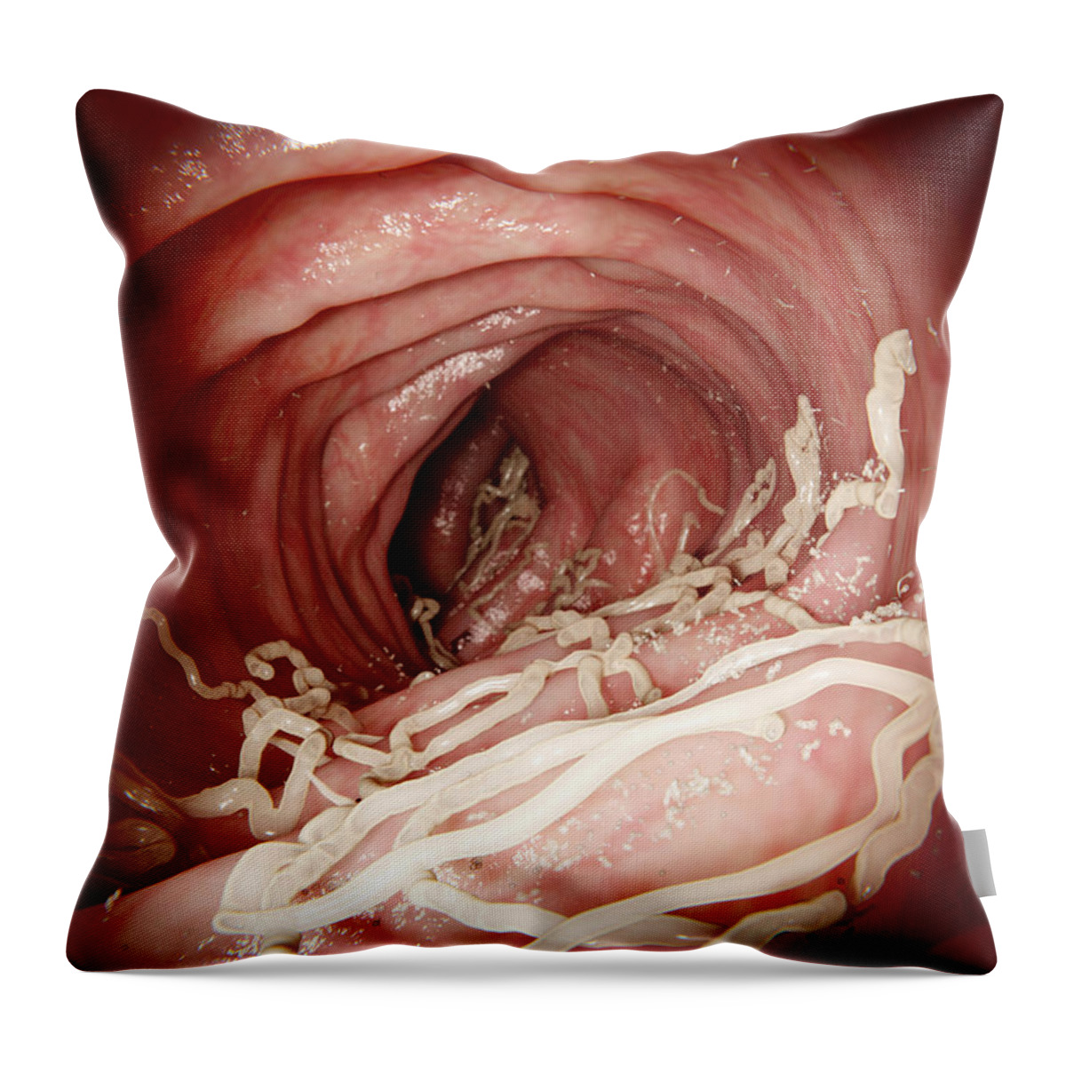 3d Artwork Throw Pillow featuring the photograph Large Roundworm In Human Intestines by Juan Gaertner