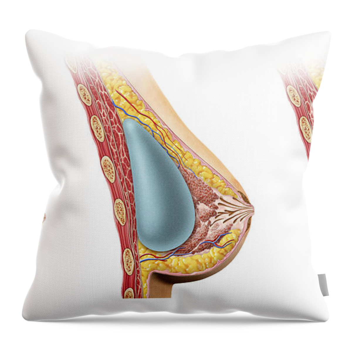 Woman Breast Implant Cross Section Throw Pillow